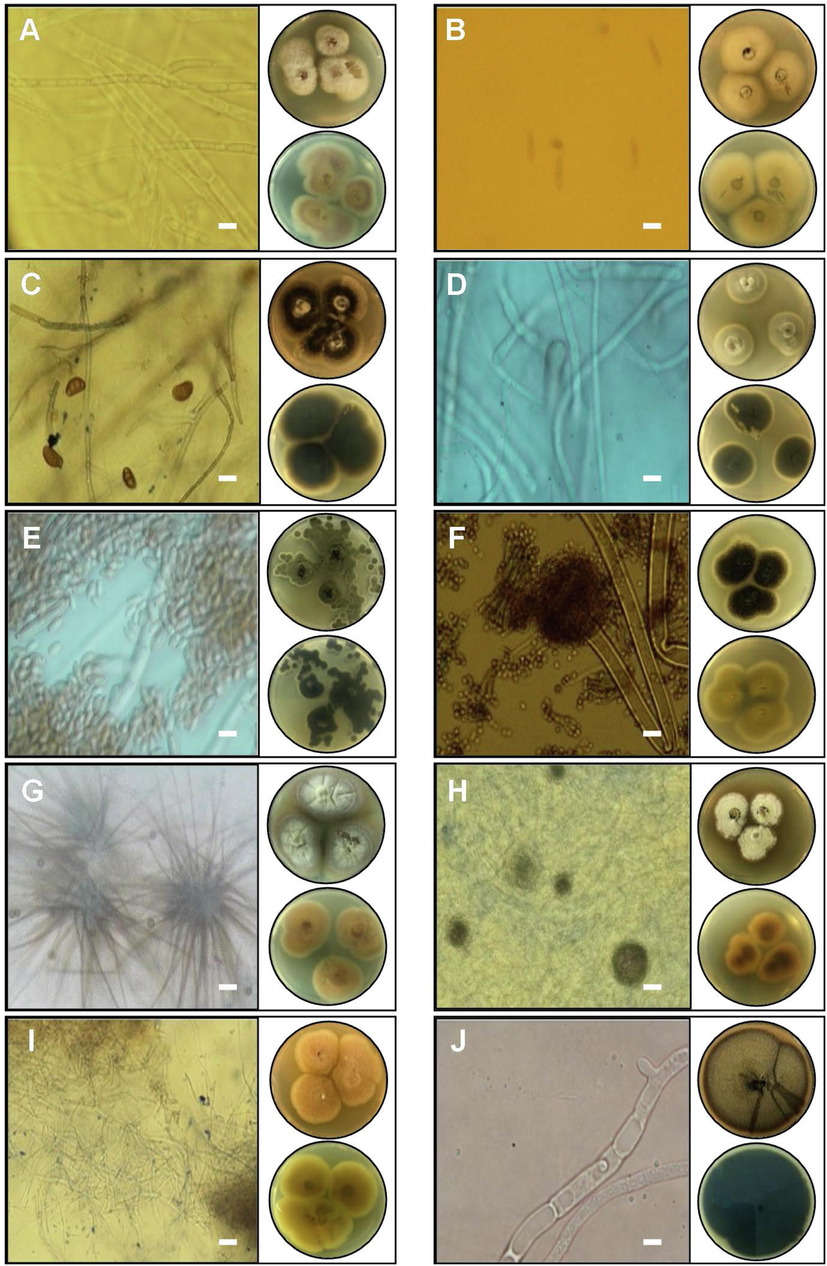 Macroscopic and microscopic characteristics of nine genera endophytes fungi isolated from aromatic and medical plants: A- Fusarium anthophilum, B- Colletotrichum trifolii, C- Curvularia subpapendorfii, D- Cladosporium tenuissimum, E- Cladosporium perangustum, F- Aspergillus niger, G- Chaetomium sp., H- Myrothecium inundatum, I- Curvularia subpapendorfii, and J- Neodidymelliopsis sp. Images of Petri dishes in each panel represent pictures from the upper and lower side. The length of the scale bar is 20 µm.