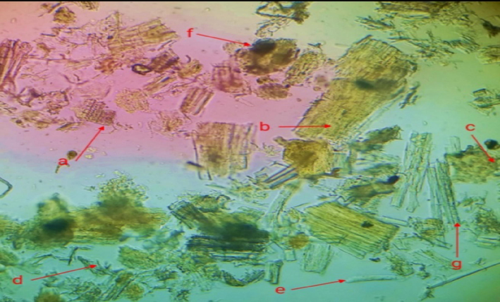 Powder microscopy of C. glaucum. (a) Annular xylem vessels (b) Fragment of cork cell (c) Cortex cells (d) Trichome (e) Calcium oxalate crystals (f) Starch granules (g) Phloem fibers.