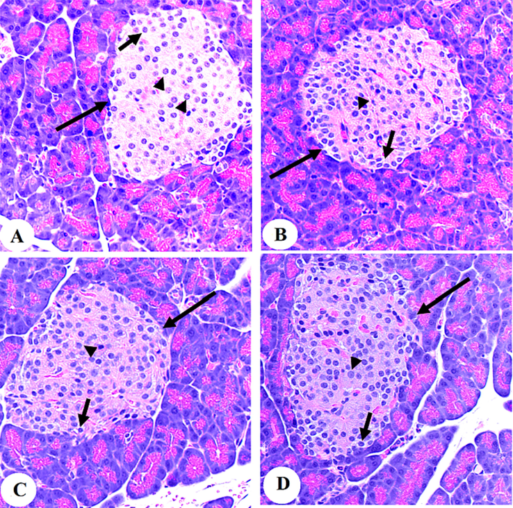 Photomicrographs of the pancreases from the control (A&B) and control + Aloin (30 mg/kg)-treated rats (C&D).