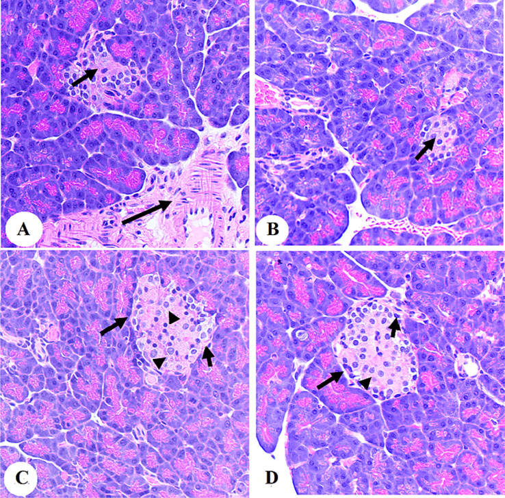 Photomicrographs of the pancreases from the diabetic rats (A and B) and diabetic + Aloin (30 mg/kg)-treated rats. In C and D: