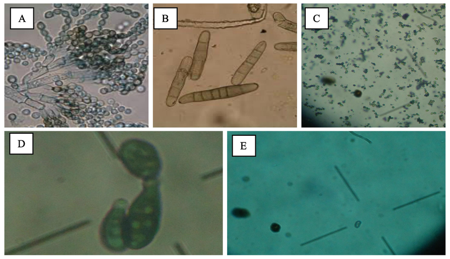 Mycoflora isolated from different wheat varieties, Penicillium (A), Drechslera (B), Aspergillus (C), Alternaria alternata (D) and Phoma (E).