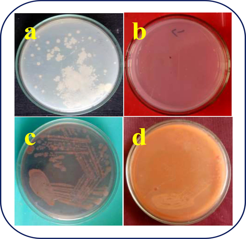 Confirmation of biofilm destruction of S. aureus by nutrient agar and congo red agar plate method using chitosan/silver nanocomposites.