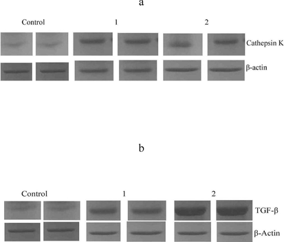 Western blotting analysis of the expression of transforming growth factor (TGF) (a), Cathepsin-K (b) and TGF-β.