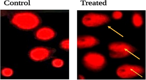 Visualization of DNA damage induced by the green synthesized SM-AgNPs on MDA-MB-231 cell lines in 24 hrs Control (A) and Treated (B).