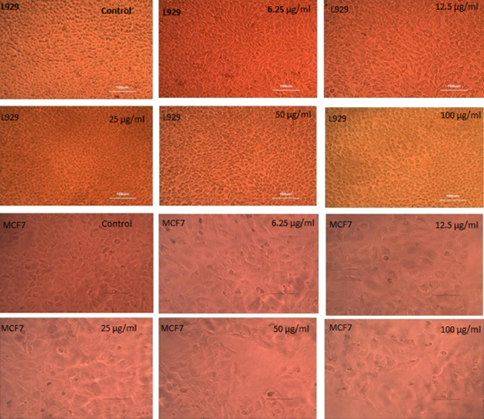 Image of L929 (normal) and MCF7 (cancer cells) of untreated control and treated with AP-AuNPs.