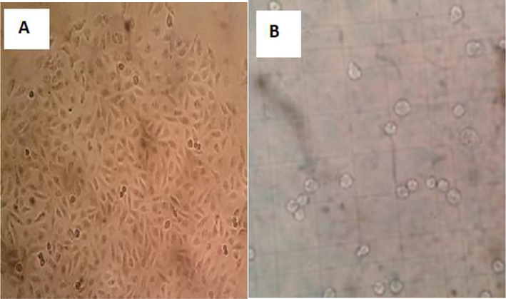 Endothelial cell culture inverted microscope image (X40) (A) and endothelial cells in thoma slides examination (B).