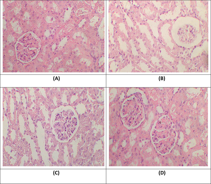 Histopathological observation of renal tissues. H&E stain; 40X (A) Group I; Normal glomeruli and tubules (B) Gentamicin treated group; necrosis in glomeruli, tubular dilation and vacuolization of tubular epithelial cells (C) Gentamicin + Glabridin treated group; normal glomeruli, rare atrophic tubules in cortex (D) Glabridin treated group; Glomeruli and tubules seem normal.