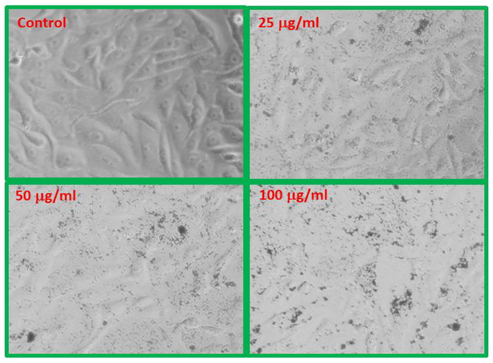 CF-NPs induced morphological changes in MCF-7 cells.