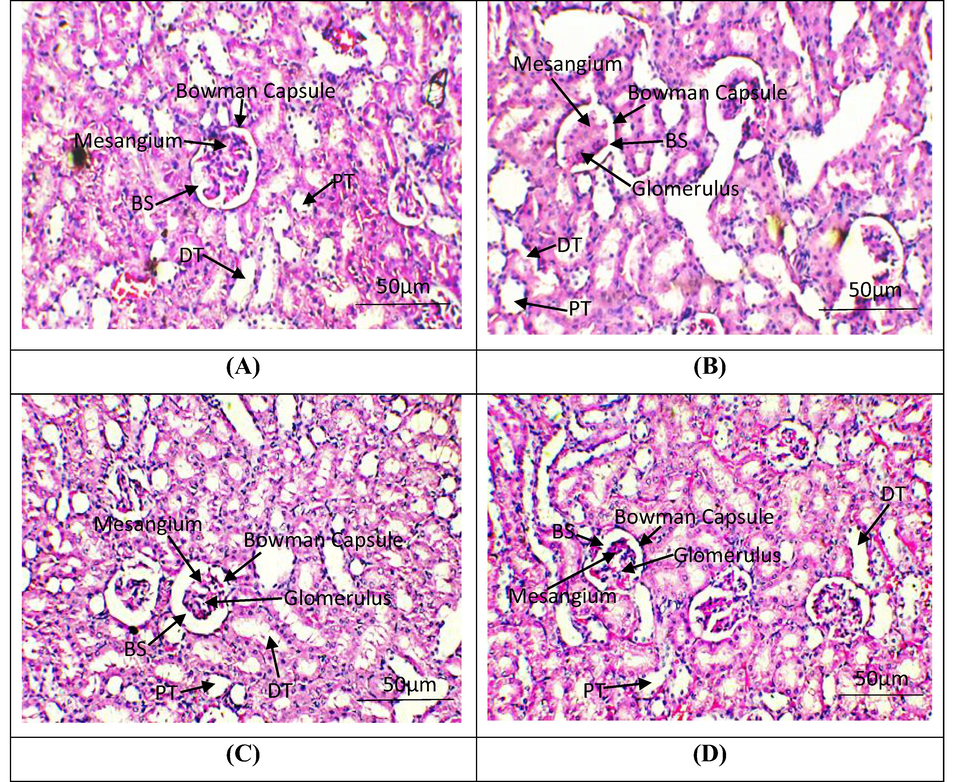 Histopathological examination of renal tissues. H&E stain; 40X (A) Group I; Normal glomeruli and tubules (B) Cisplatin intoxicated group; necrosis in glomeruli, tubular dilation and vacuolization of tubular epithelial cells (C) Cisplatin + Tamarixetin Co-administrated group; normal glomeruli, rare atrophic tubules in cortex (D) Tamarixetin supplemented group; Glomeruli and tubules seem normal. BS, Bowman Space; PT, Proximal convoluted tubules; DT, Distil convoluted tubules.