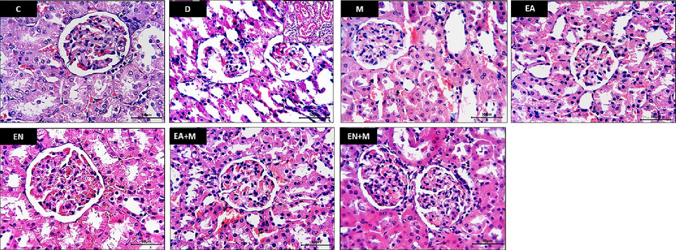 Effect of EA, EN, EA + M, and EN + M on rats’ kidney histopathology determined in all experimental groups. Photos presented H & E-stained sections photographed at x400 magnification (Bar = 50 µm). C: control group, D: diabetes group, M: metformin group, EA: ellagic acid group, EN: nano-formulated ellagic acid group, EA + M: ellagic acid + metformin group, and EN + M: nano-formulated ellagic acid + metformin group.