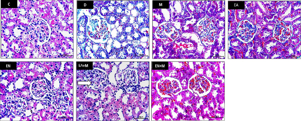 The impact of EA, EN, EA + M, and EN + M on kidney collagen formation was evaluated in all experimental groups. Photos presented Masson’s trichrome stained sections photographed at x400 magnification (Bar = 50 µm). C: control group, D: diabetes group, M: metformin group, EA: ellagic acid group, EN: nano-formulated ellagic acid group, EA + M: ellagic acid + metformin group, and EN + M: nano-formulated ellagic acid + metformin group.