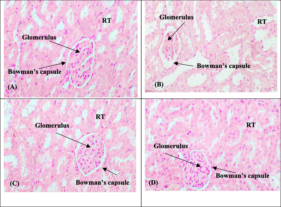 Remedial potential of GTIN on DOX instigated renal histological damages. (A) Control group (B) DOX intoxicated group (3 mg/kg) (C) GTIN + DOX co-treated group (30 mg/kg + 3 mg/kg) (D) GTIN supplemented group (30 mg/kg). RT: Renal tubules.