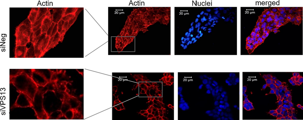 Chorein silencing influences microfilament organization in ZF cells. Confocal laser scanning microscopy of actin and nuclei in chorein-silenced (siVPS13A, upper panels) and control (siNeg, lower panels) ZF rhabdomyosarcoma tumor cells. Scale bars represent 20 μm.