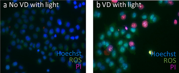 VD-PDT reduces cell viability of human KB carcinoma cells. Merged image of Hoechst (blue), PI (pink) and ROS (green) of: (a) Untreated KB cells shows only signal from Hoechst and ROS, (b) VD treated KB cells shows PI (pink), Hoechst (blue) and ROS (green).