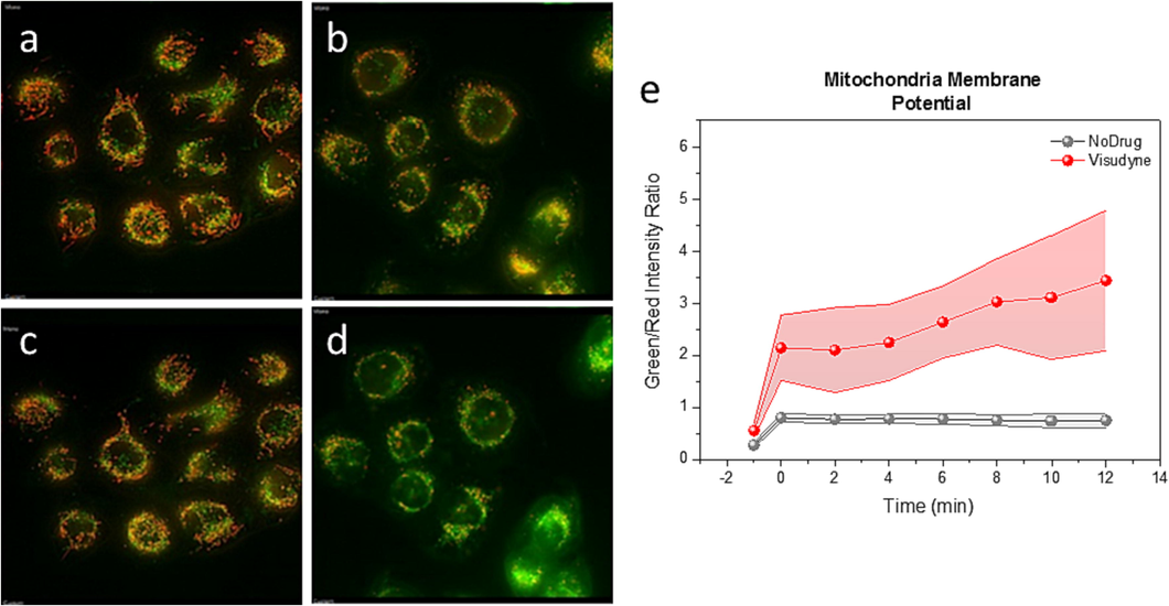 VD-PDT reduce mitochondria membrane potential in human KB-cells. JC-1 signal in control cells (a, c), (a) before (c) after light treatment and VD treated cells (b, d), (b) before and (d) after light treatment. (e) Green to red channel ratio during longitudinal study for 12 min upon light treatment on VD treated KB-cells (red) and control (no VD) cells (grey). The difference in each point is statistically significant (P < 0.001).