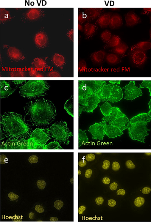 VD-PDT treatment in KB cells leads to changes in intracellular structures after irradiation. Mitochondria morphology (a, b) and Actin cytoskeleton (c, d) show more diffused structure after light treatment in VD treated cells: (b) mitochondria, and (d) actin cytoskeleton compare to (a) mitochondria and (c) actin cytoskeleton in no VD treated cells after light treatment. DNA condensation is observed in VD treated cells after light treatment (f) compare to no VD treated cells after light treatment.