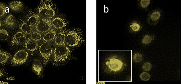 VD-PDT treatment leads to apoptosis in human KB cells. Anti-Cytochrome C in human KB-cells after light treatment in (a) no VD (b) VD treated cells show cell blebbing (inset).