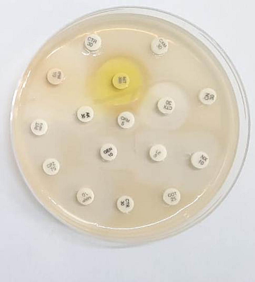 Antibiotic susceptibility of H. pylori isolated from the suspected gastritis sample.