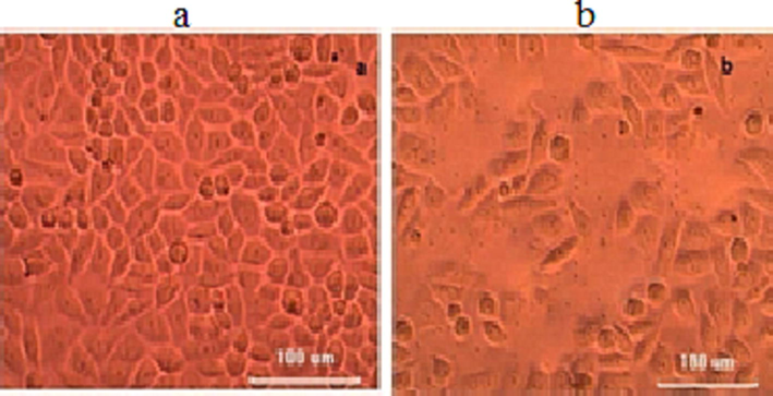 Effect of cell-free culture of H. pylori JK on HeLa cell lines. The cell-free extract (strain JK) was applied on the HeLa monolayer (a) and HeLa cells treated with unioculated strain (b).