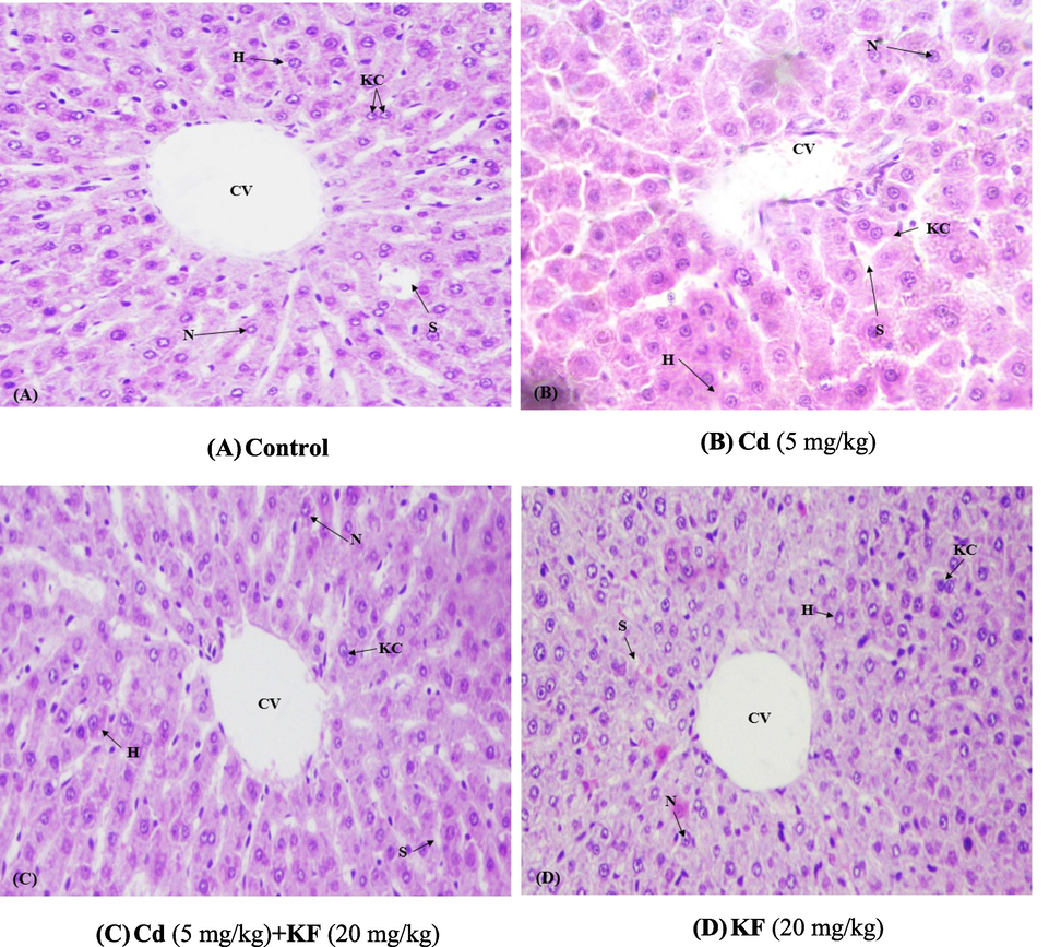 Protective role of KF on histopathology of liver (400X /H&E). (A) Control group (B) Cd administered group (5 mg/kg). (C) Cd + KF co-treated group (D) KF administrated group (20 mg/kg).