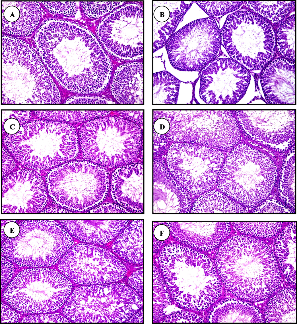 Light micrographs of testis sections of control (A), Pb(B), chia oil plus Pb(C), canola oil plus Pb(D),chia oil (E) and canola oil (F)treated rats(H & E staining, X200).