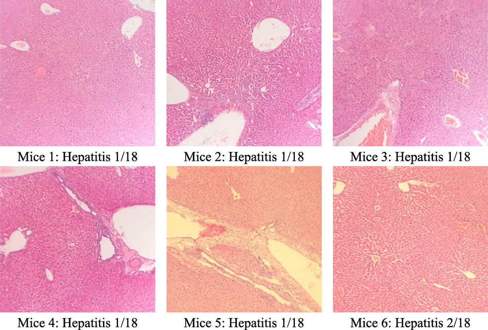 The microscopic structure of mice liver cells in high oral C. flavescens dose 1200 mg/kg.