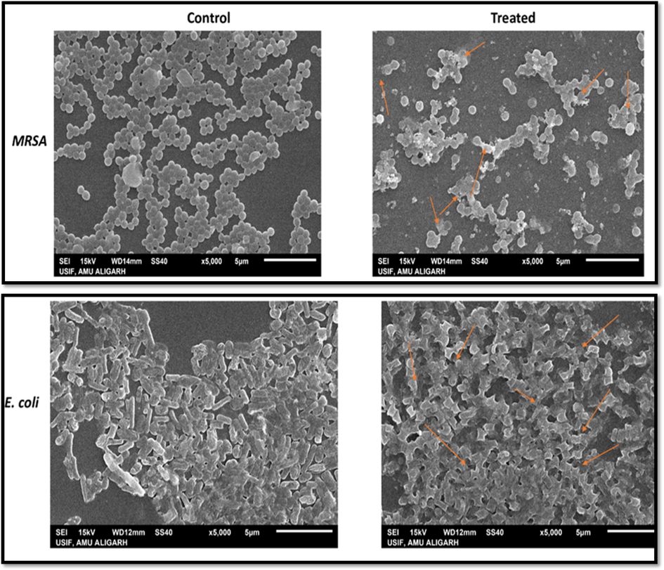 Scanning electron micrograph of MRSA and E. coli grown in the presence and absence of Pn-AgNPs. (Control) Untreated, with intact cell wall, no change in morphology; (Treated) treatment with Pn-AgNPs at 35 µg/ml, cell wall damage, cell distortion and clumping.