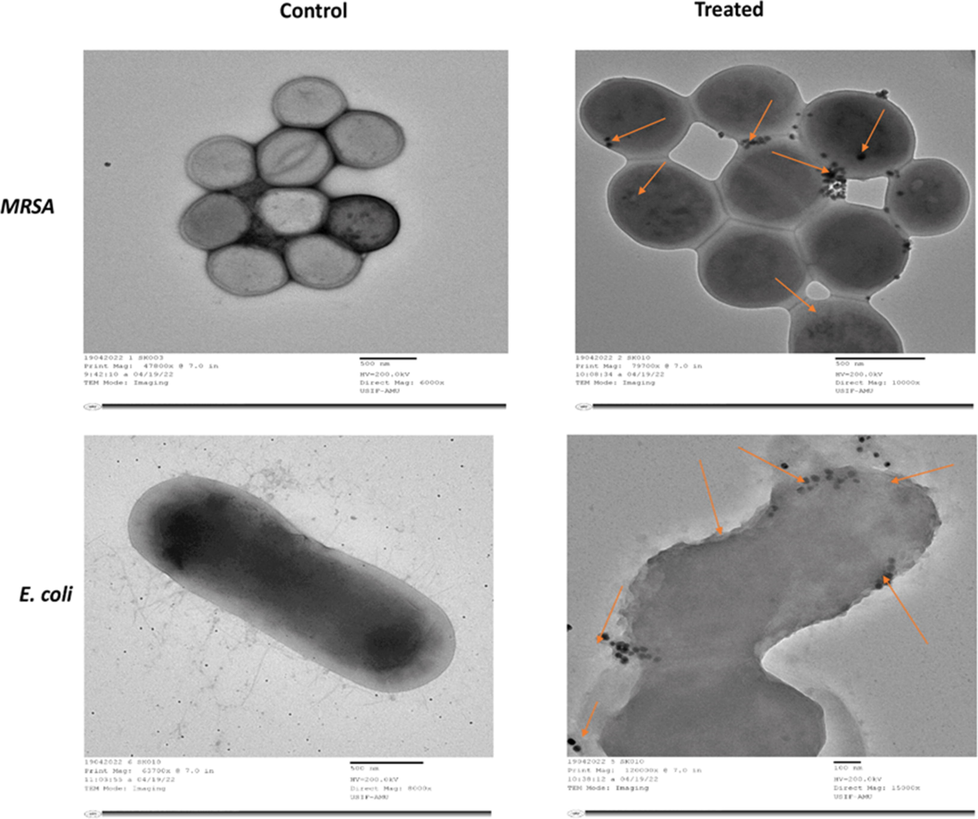 Transmission electron micrograph of MRSA and E. coli grown in the presence and absence of Pn-AgNPs. (Control) Untreated, with intact cell wall and organelles; (Treated) treatment with Pn-AgNPs at 35 µg/ml, cell wall damage, loosening of cell membrane; lysis and shrinkage and penetration of AgNPs.