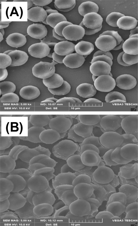 SEM image of (A) untreated RBC and (B) RBC treated with 1.25 mM SPAgNPs.