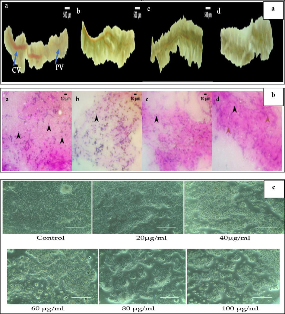 a&b: 4a- Liver anatomy of zebrafish treated with nanocomposite concentration of 1 ng (b), 10 ng(c), 100 ng (d). Control (a) shows the intact structure of liver with a continuous serosa layer forms the outermost layer of the parenchyma. The central veins run through the longitudinal center of each lobe and the scattered portal vein throughout the parenchyma. The 1 ng (b), and 10 ng(c) treated groups shows the liver anatomy similar to control (a). In 100 ng (d) group the liver appears normal with the entire parenchyma, whereas the central vein appears mildly pale. The anatomical image were viewed under Labomed CM4 stereomicroscope at 10X magnification. 4b-The liver cytology of zebrafish treated with nanocompsite concentration of 1 ng (b), 10 ng(c), 100 ng (d). Control (a) the cytological features with evenly distributed hepatocytes with no evident cellular necrosis. The parenchyma of the liver is composed of hepatocytes with a spherical nucleus on the eosinophilic cytoplasm. In 1 ng (b), and 10 ng(c) group shows the uniform distribution of the stain uptake appeared with well-defined hepatocytes on the eosinophilic cytoplasm, which is similar to control (a) group. In 100 ng, (d) nanocomposite treated group shows the shrunken nucleus identified no necrotic hepatocytes. The cytological image is observed under Labomed LX 400 Light microscope at 400X magnification. c. Effect of different concentration of nanocomposite on cytotoxicity of Hep G2 (Liver cancer) cell line as determined by the MTT assay.