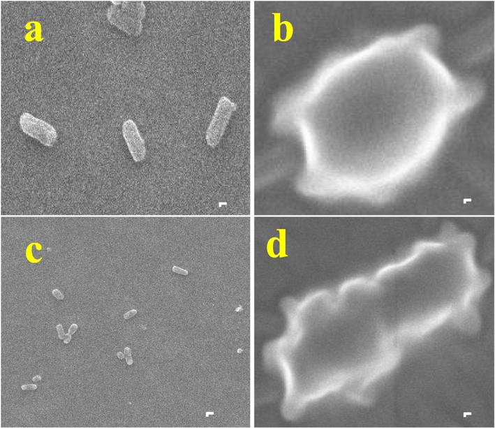 Outer cellular morphological differentiation of control and R. mucronata extract treated K. pneumoniae (a) and A. baumannii (b).