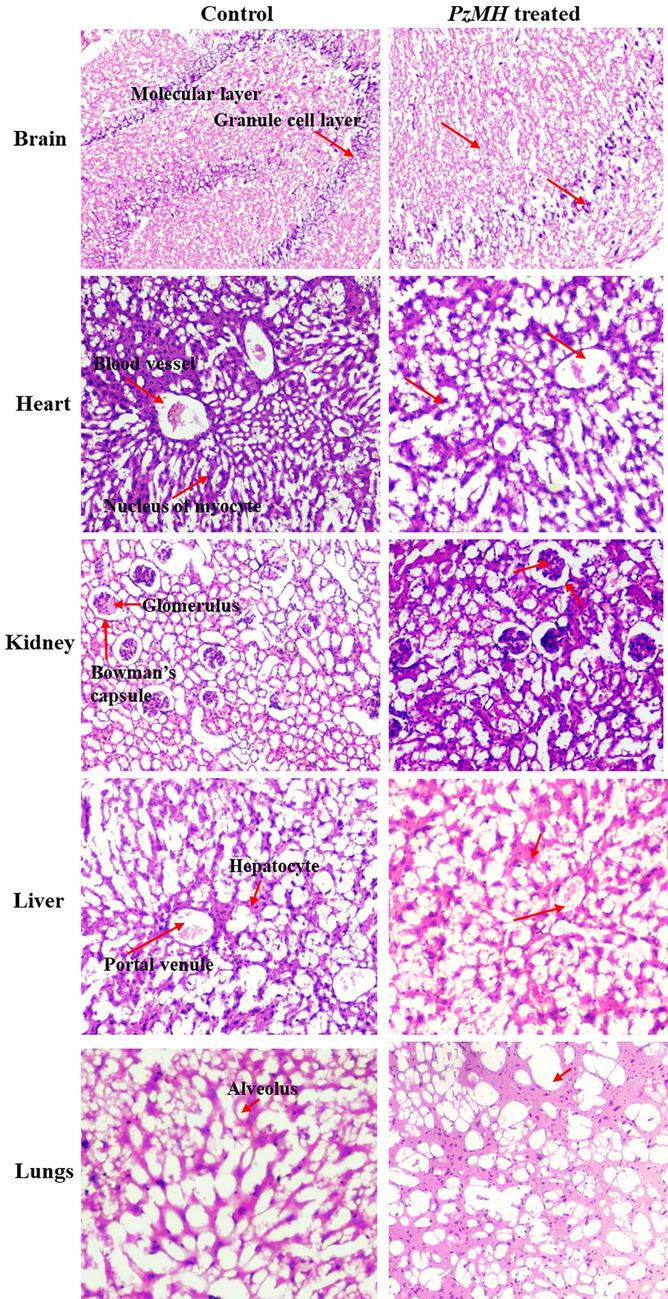 Photomicrographs of different organs showing histopathology of control and PzMH treated mice.