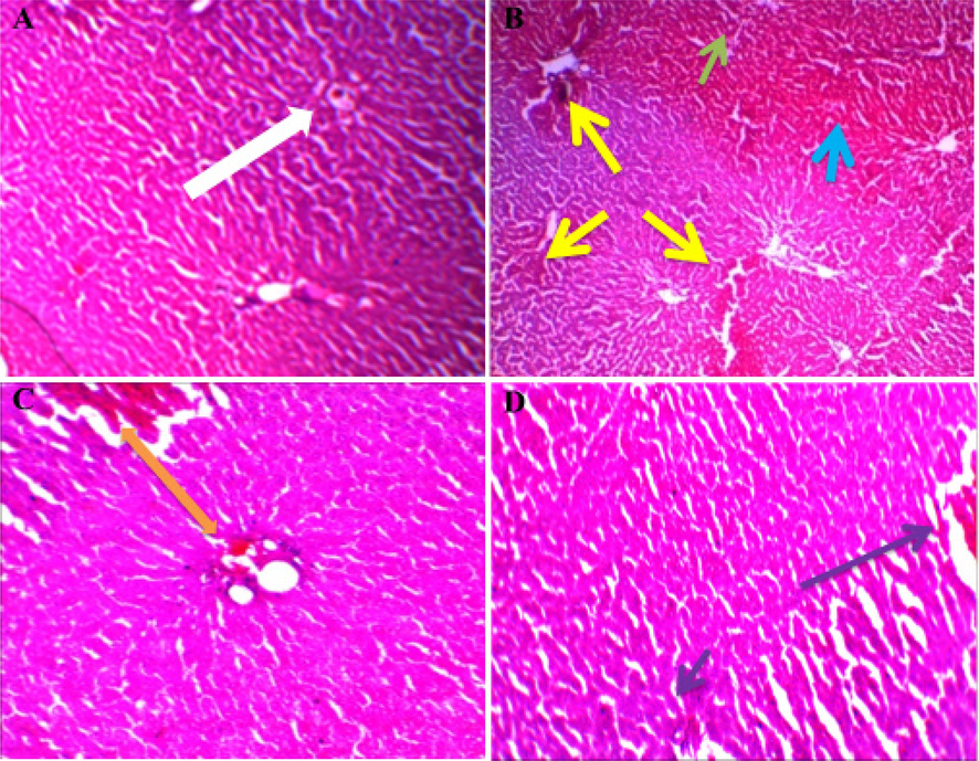 Representative photographs demonstrating histopathological finding of liver tissue sections stained with H and E among various experimental groups. Histological examination of liver sections from different groups (A) Group I: White arrow indicated a normal arrangement of hepatocytes. (B) Group II (section of liver tissue of the D-GalN-treated group): yellow arrow indicating massive coagulative necrosis, a green arrow indicating central vein congestion, and blue arrow indicating inflammation. (C) Group III (section of liver tissue pretreated with 25 mg/kg Butin followed by D-GalN): an orange arrow indicating moderate tissue necrosis and mild inflammation. (D) Group IV (section of liver tissue pretreated with 50 mg/kg butin followed by D-GalN): a purple arrow indicating normal histology with mild inflammation.