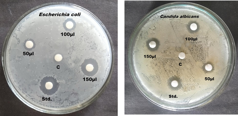 Anti-microbial activity of Ficus racemosa plant sample.