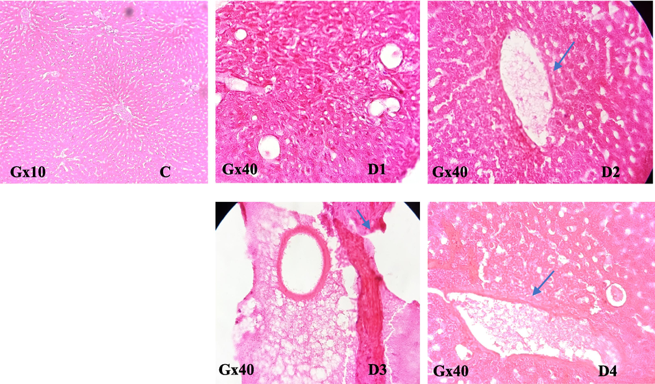 Effect of EtOAc fraction of H. strobilaceum on the liver of treated black rats compared to control.