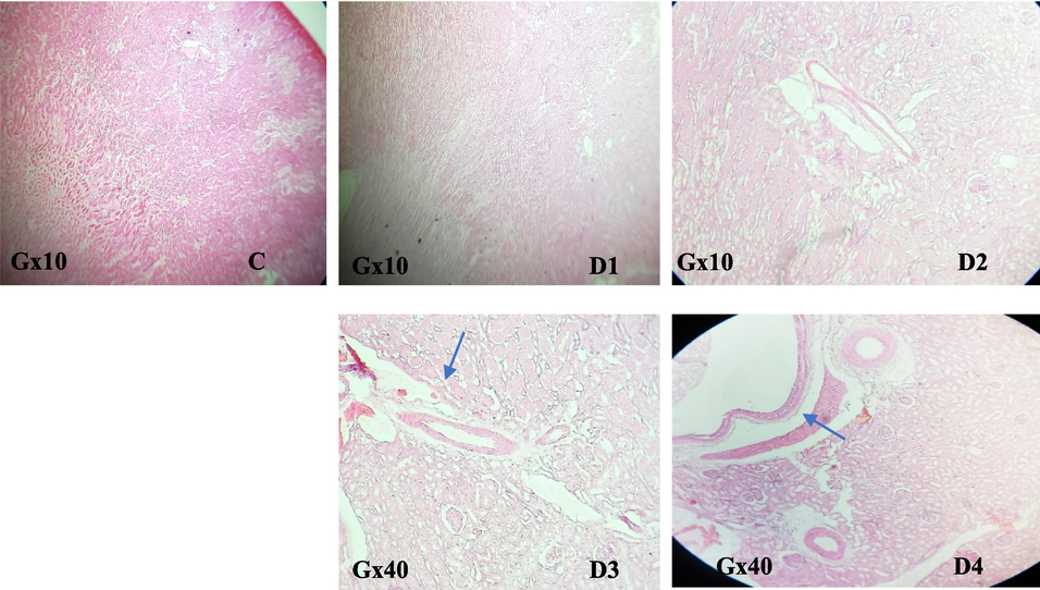 Effect of EtOAc fraction of H. strobilaceum on the kidney of treated black rats compared to control.