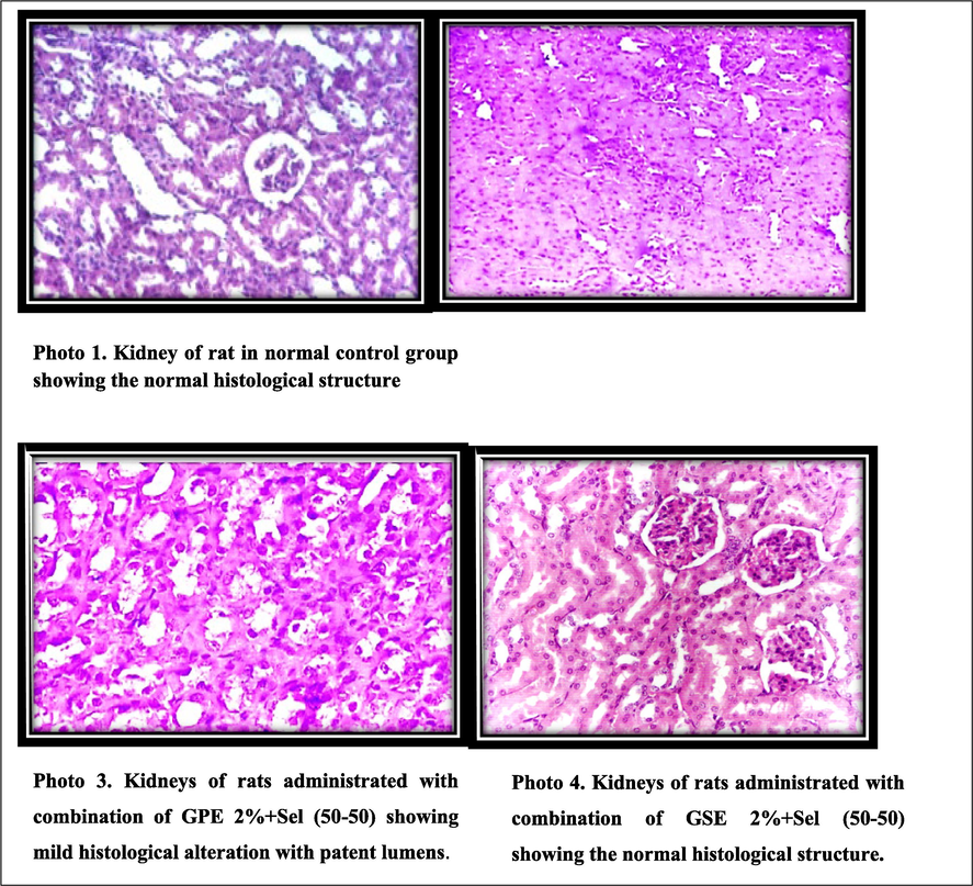 Histopathological assessment of the kidneys of OTA-induced nephrotoxic rats by the treatment of GSE, GPE and/or selenium (Microcroscopical examination at H and EX 200).