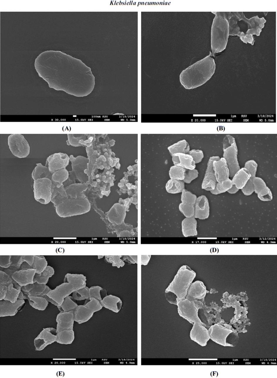 FE-SEM images of the resulting effect upon K. pneumoniae of untreated (A and B), synthesised AvAgNPs (C), CS of S. aureus-AgNPs (D), chloramphenicol (E), chloramphenicol with CS of S. aureus-AgNPs (F).