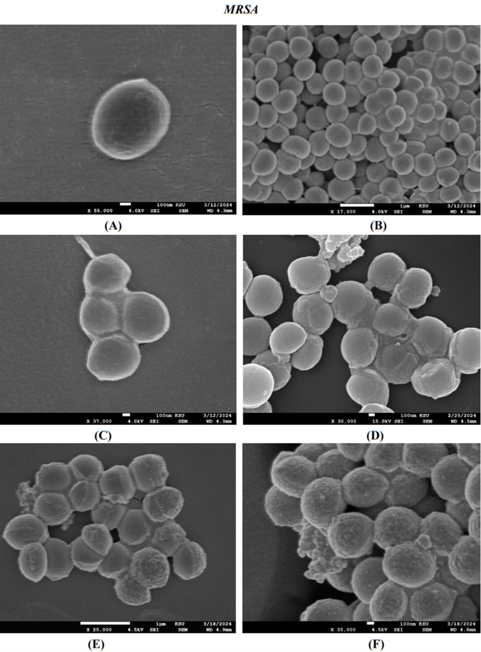 FE-SEM images of the resulting effect upon MRSA of untreated (A and B), synthesised AvAgNPs (C), CS of S. aureus-AgNPs (D), chloramphenicol (E), chloramphenicol with CS of S. aureus-AgNPs (F).