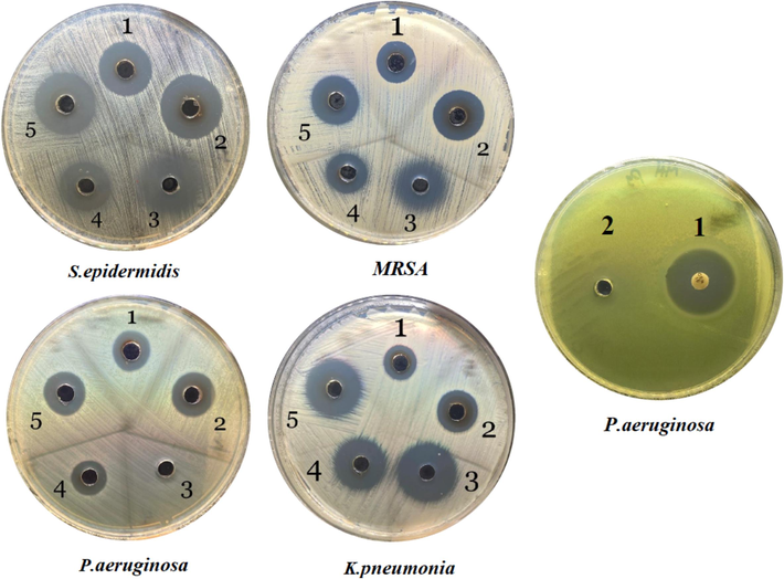 The antibacterial effect upon different bacterial strains treated with AV-AgNP (1), CS of S. aureus-AgNP (2), chloramphenicol (3), AV-AgNP + chloramphenicol (4), CS of S. aureus-AgNP + chloramphenicol (5).