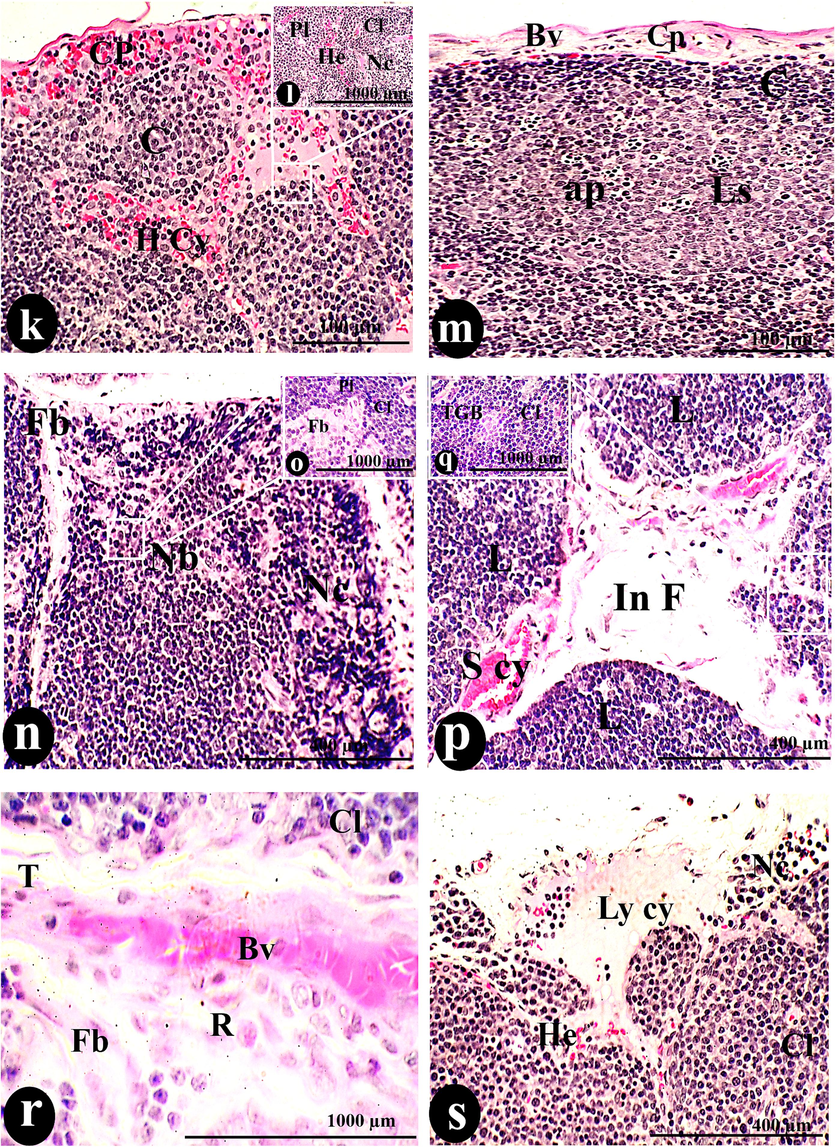 A photomicrograph of a cross-section of the thymus was administered orally with 300 µg/body weight of SAV, showing the thymus had no border (Nb) between the C and M regions. Hemorrhage (He), lymphocyte depletion (de), and epithelial inclusion (E inc) infiltrated the Cp. The thymic cortex was deformed by Th d, Cy, simple cyst (S cy), hyperplasia of plasma cells (Pl), tangible bodies (TGB), Fb, and H cy, side by side of Cl. The Md, consisting of H, Ml, R, and DC, occupied the medullary tissue. The tissue was dotted with small Bv and lesions (Ls) containing apoptotic cells (ap). Necrosis (Nc) and fibrosis throughout the entire tissue, represented by the interlobular fibrotic tissue (in Fb) that occupied the space of the T, were the characteristic signs of this dosage. Cortical hemorrhage (He) coincided with the lymphatic cyst. Scale bars; a, c, e& g = 100 µm; b, d, f, h, I, k, m, n, p & s = 400 µm; j, l, o, q &r = 1000 µm.