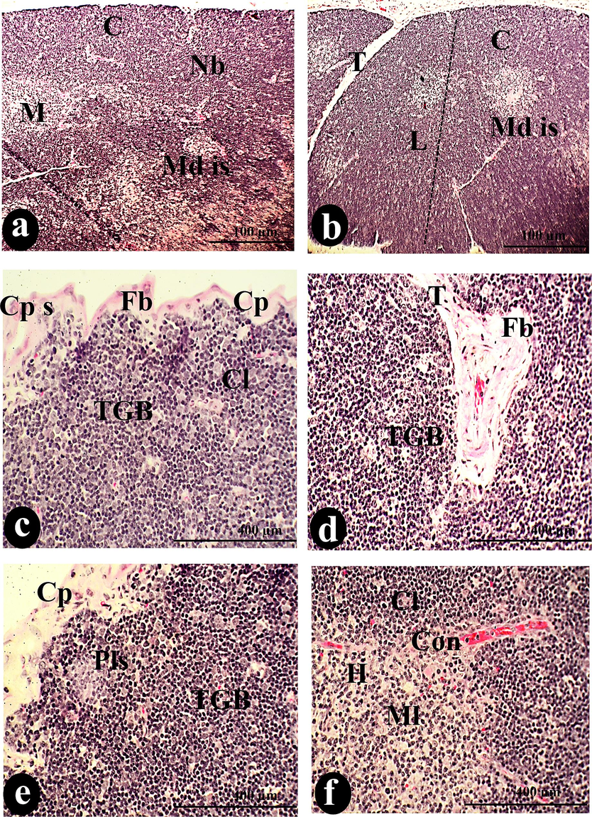 A photomicrograph of a cross-section of the thymus was administered intraperitoneally with (450 µg/body weight) of SAV, showing the thymic lobule (L) lack of the border (Nb) between the C and M. The fibrosis (Fb) invaded the Cp, Cps, and T. The MD was spreading over all the tissue, accompanied by congestion of the blood vessels (Con). There were tangible apoptotic bodies (TGB), Cy)of two types H cy and Ly cy, and pale lesions (Pls), which represented abnormal features distributed among Cl and Ml. Reticular cells (R) and MC constitute the cortical stroma. Histocyte dispersion (His) and Nc were the distinguishing signs of this thymus. Bv and Md cor occupied the medullary island. Scale bars: a, b, g = 100 µm; c, d, e, f, i, j &l = 400 µm; h &k = 1000 µm.