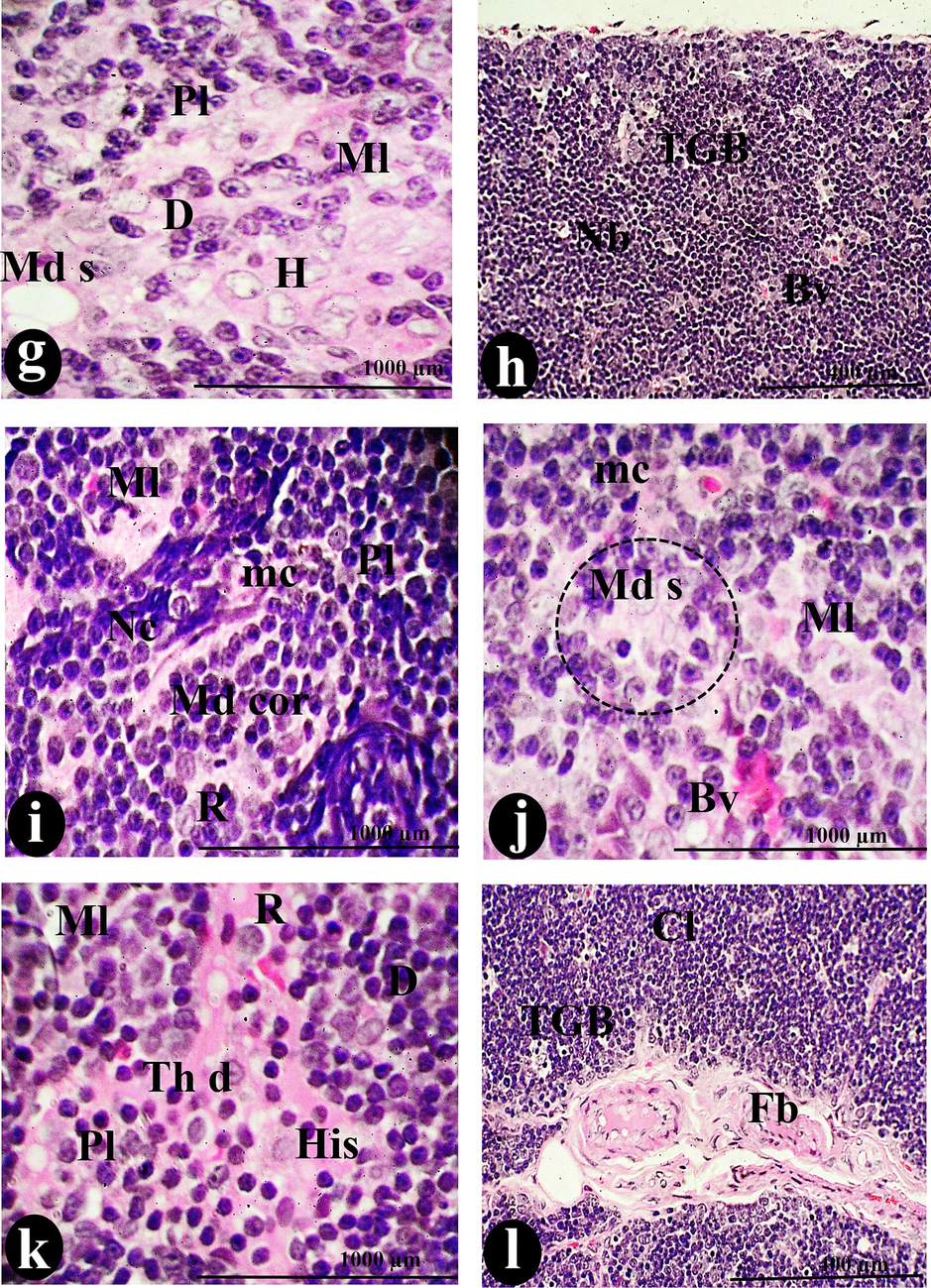 A photomicrograph of a cross-section of the thymus was administered intraperitoneally with 100 µg/body weight of SAV, showing the L with Fb in the Cp, T, and penetrating the Cl. Tangible bodies (TGB), Pls, and Cy constituted an aberrant picture of thymic structure. Macrophages (mc), R, dendritic cells (D), and Bv invade the cortical stroma. Depleted lymphocytes (de) fill the cortical sinus (S). Thymic hyperplasia (Pl), Th d, His, and Nc are all signs of the tumor that has spread all over the thymus The Ml disperses the Md cor, and Md s. Scale bars: a, b, g = 100 µm; c, d, e, f, i, j &l = 400 µm; h & k = 1000 µm.