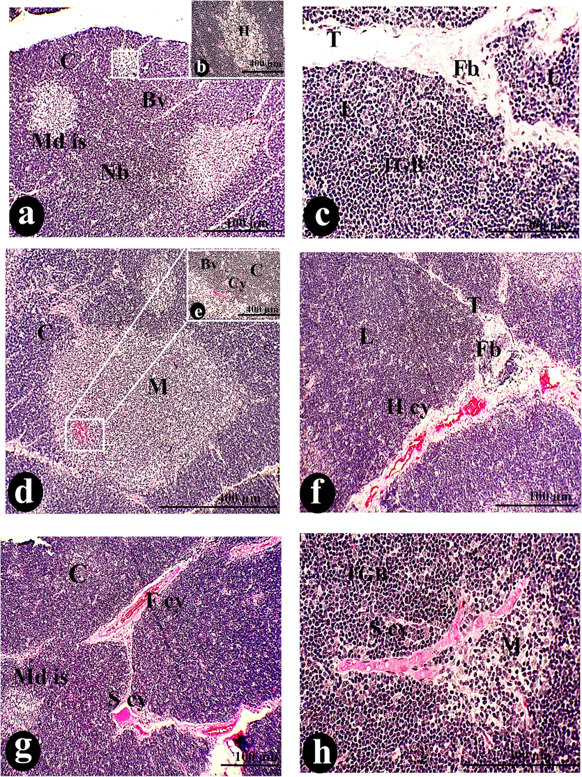 A photomicrograph of a cross-section of the thymus was taken after 50 µg/body weight of SAV was injected intraperitoneally. It showed that there was no border junction (Nb) between the C and its Cl and the M and its Ml. The Md appeared with the normal appearance of Hessel's corpuscles (H), accompanied by Bv. Fibrosis (Fb) covered the T that separated the thymic L. Thymoma markers included H cy, TGB, and a variety of Cy, including F cy, S cy, congested blood vessels (con), Nc, and hyperplasia of plasma cells (Pl). Reticulated cells (R), MC, Dc, ED, and His condense on the medullary island, in addition to Md s and cords Md cor. Scale bars: a, f, g, i, and j = 100 µm; b, c, d, e, and h = 400 µm; k, l, m, and n = 1000 µm.