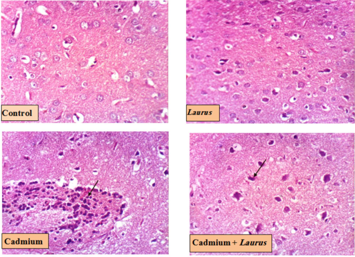 Brain photomicrograph (cerebral cortex) for Control and treated groups (H & EX 400, Scale bar 50 µm).