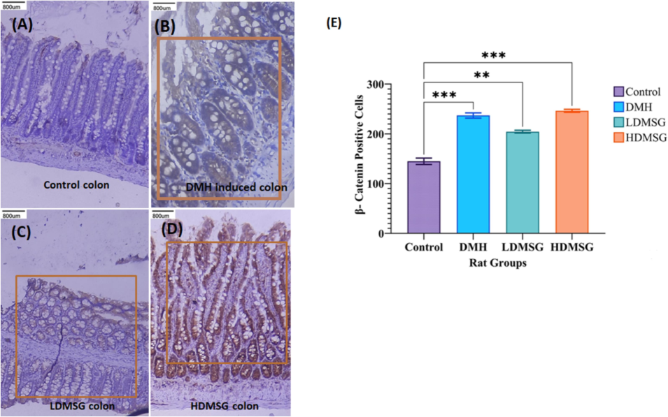 Immunohistochemistry for β-catenin Expression in Colon Tissues. (A) Control Colon: Negative staining. (B) DMH-Induced Colon Cancer Rat Group: Positive immunohistochemical staining of β-catenin, indicating its expression associated with cancer. (C) LDMSG Rat Colon: Positive staining for β-catenin expression. (D) HDMSG Rat Colon: Positive staining for β-catenin in the colon of rats treated with a high dose of MSG. The orange rectangles in panels B, C, and D indicate the selected regions for β-catenin quantification. (E) Quantification of β-catenin IHC Expression: Results are presented as mean ± SD (n = 3). Error bars represent standard deviation. Statistical significance is indicated by asterisks: **p < 0.01, ***p < 0.001.