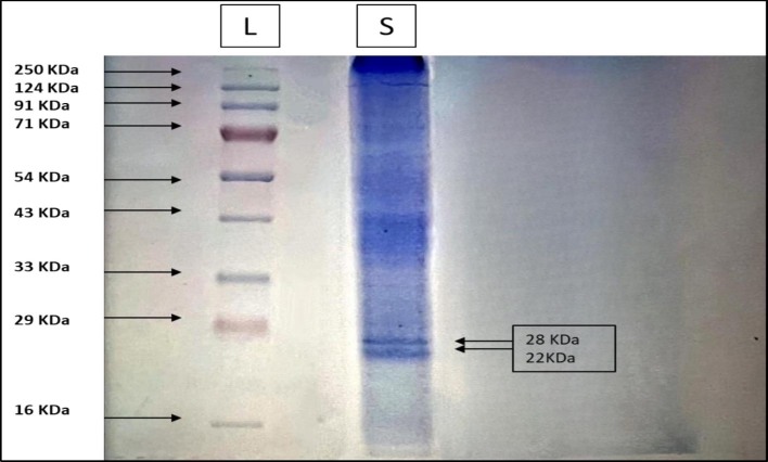 SDS-Page of the purified sample was carried out, the image shows the protein ladder and the bands of the sample showing two subunits of 28 KDa and 22 KDa.