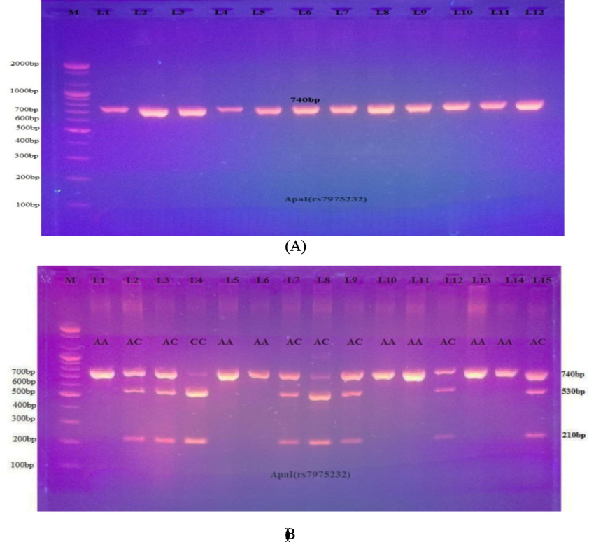 A: PCR results for the VDR gene (Apa1, 740 bp). 2-B: Electrophoretogram of DNA fragments for ApaI variations after ApaI digestion. Homozygote A/A was indicated by the bands at 740 bp. The bands at 530 and 210 bp indicated homozygote C/C. Heterozygous A/C was indicated through the bands at 740, 530, and 210 bp.