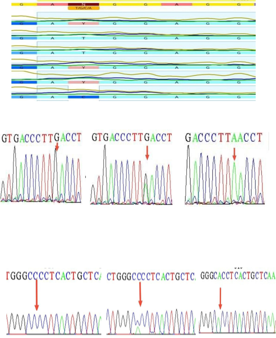 DNA sequencing of Fok1 (CC, CT, and TT) in the upper section, Tru91 (GG, GA, and AA) in the middle, and Apa1 (CC, AC, and AA) in the lower portion.