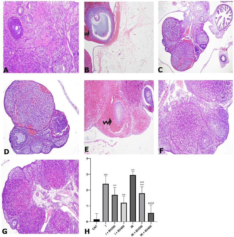 Hematoxylin and eosin (H&E) staining photomicrographs of all experimental groups. A) CNT, 10X; B) I, 10X; C) I + BV200, 10X; D) I + BV400, 10X; E) IR, 10X; F) IR + BV200, 10X; G) IR + BV400, 10X; curved arrows signify hemorrhagic areas. H) Histopathological scoring results for hemorrhagic areas. *: Compared to CNT; +: comparing I + BV groups with I; #: comparing IR + BV groups with IR. CNT: Control; I: ischemia, IR: ischemia + reperfusion; *, +, #: p<0.05; **, ++, ##: p<0.01; ***, +++, ###: p<0.001.